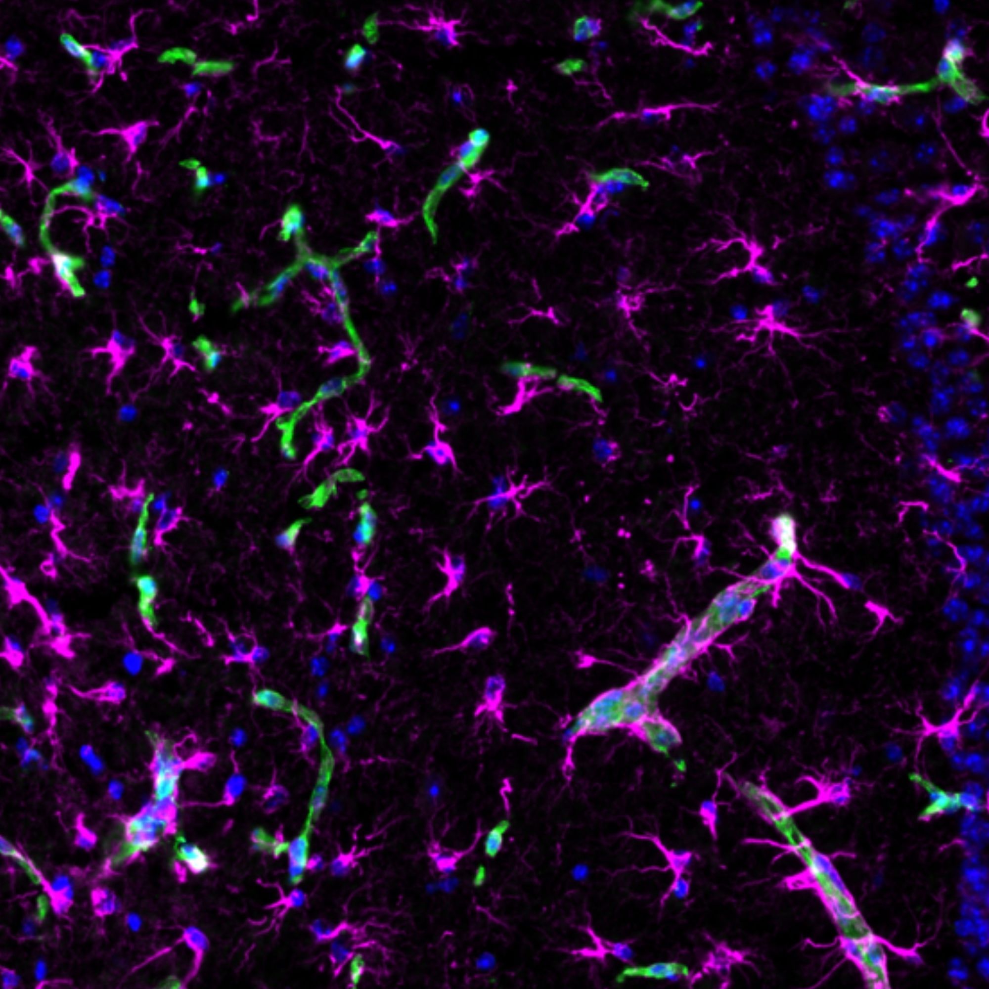 astrocytes and vessels 3